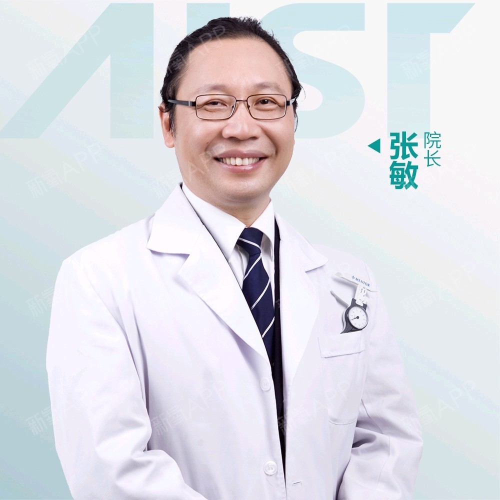 张敏