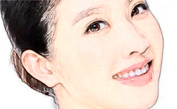 海峡美容整形医院做拉皮多少钱