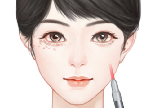 郑州爱都沪美人做双眼皮多少钱
