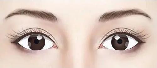 成都美容医院做双眼皮多少钱