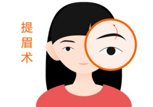 上海九院提眉割眼袋需要多少钱