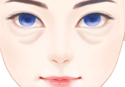 昆明华美美莱做眼袋多少钱