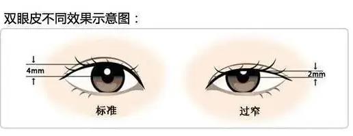 上海安缦整形做双眼皮多少钱