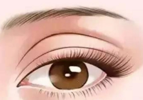 浙江艺星医美双眼皮多少钱