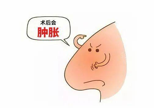 横岗人民医院隆鼻多少钱